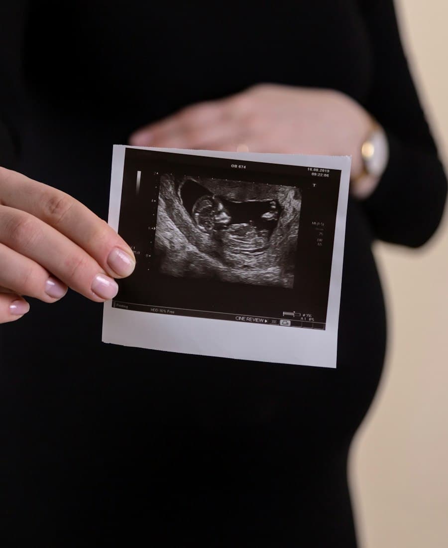 Imagem de ultrassom segurada sobre a barriga