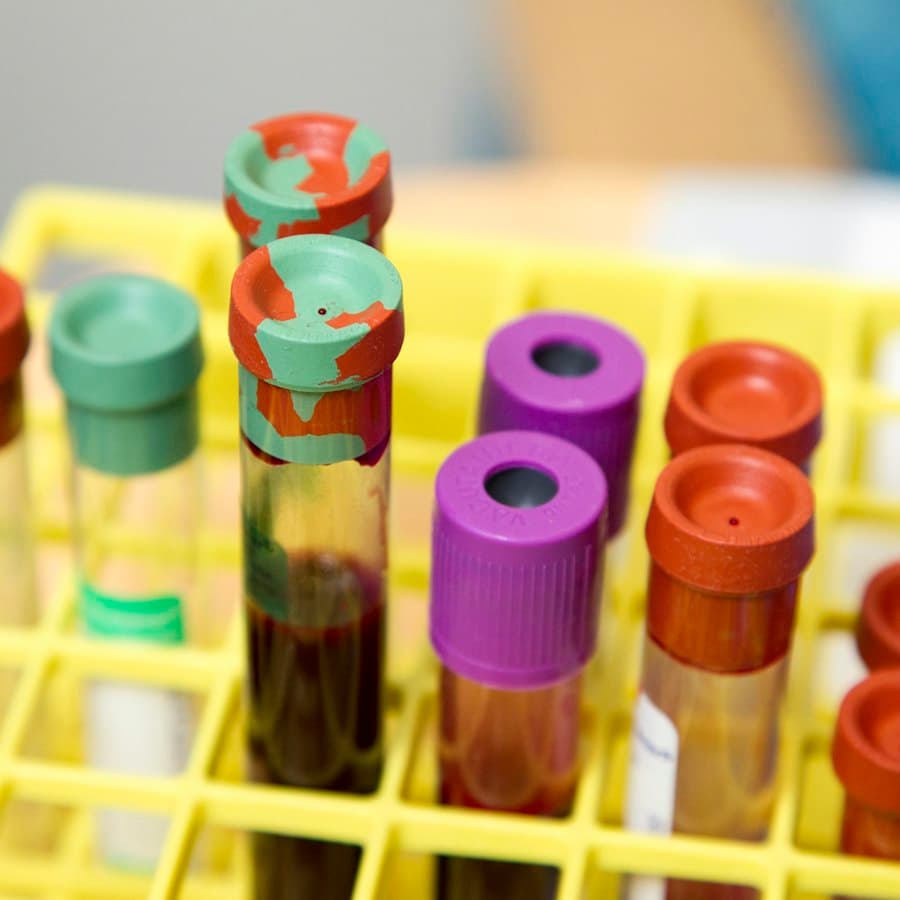 Tubos de coleta de sangue em uma estante