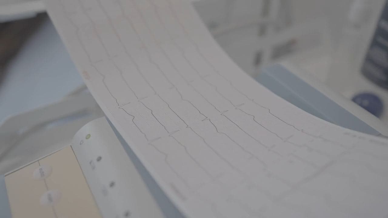 Eletrocardiograma sendo impresso